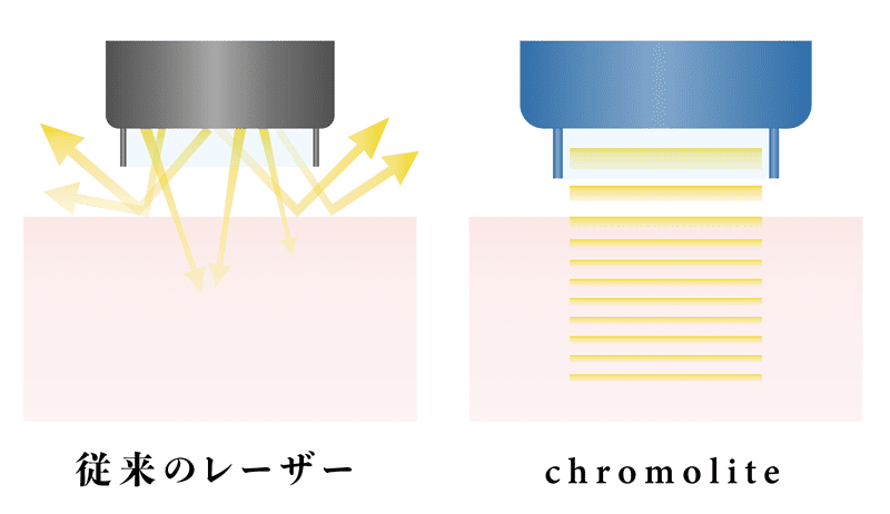 従来のレーザーとクロモライトの波長の比較