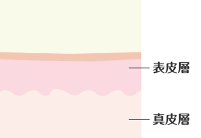 修復された肌の断面図