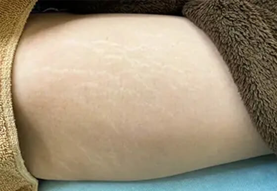 施術前