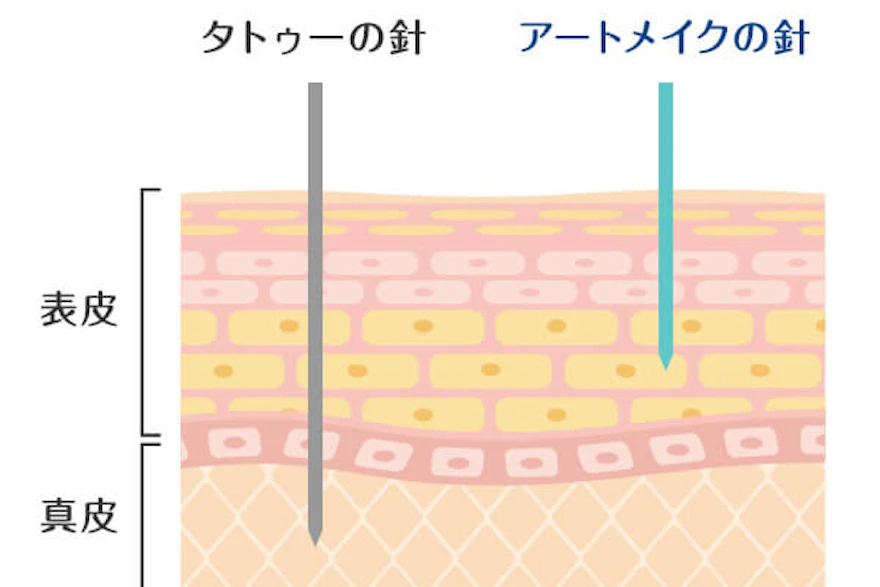 アートメイクは医療行為