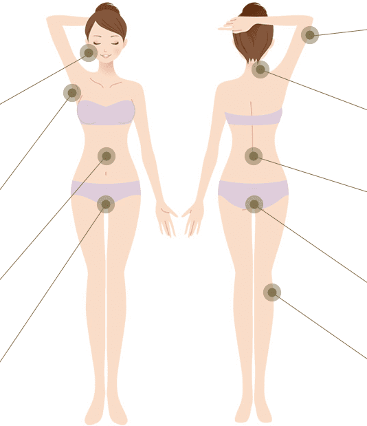 脱毛部位一覧の全身図イラスト