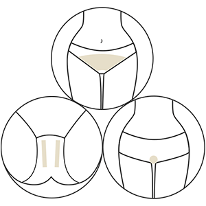 ハイジニーナ脱毛 5回