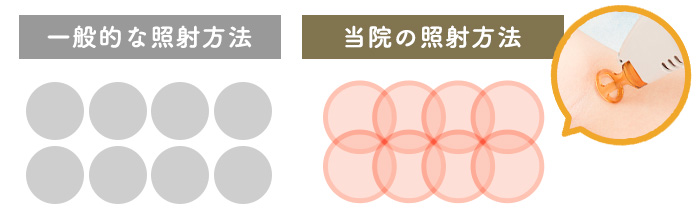 打ち漏れを防ぐ照射方法