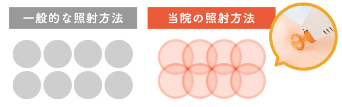 照射漏れを防ぐ重ね打ち