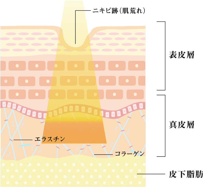 施術当日