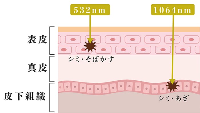 肌の断面図とQスイッチYAGレーザーの波長の種類