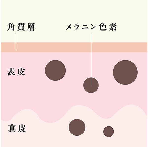 シミのできた肌の断面図