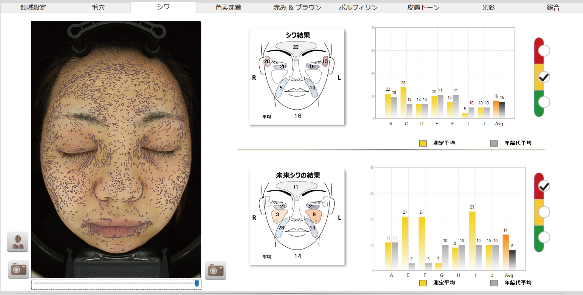 Neo Voirの比較結果