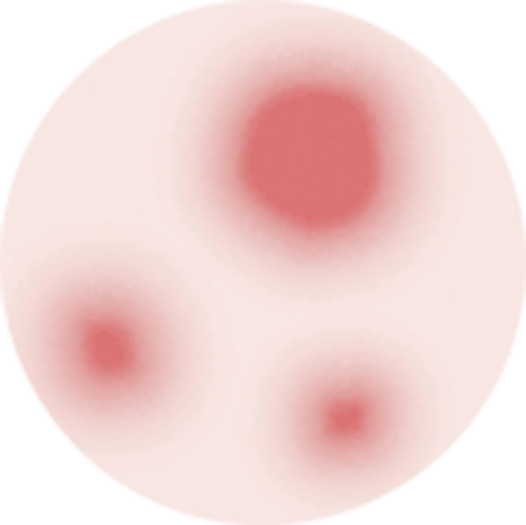 赤み
