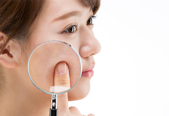 肌のザラつき・キメ