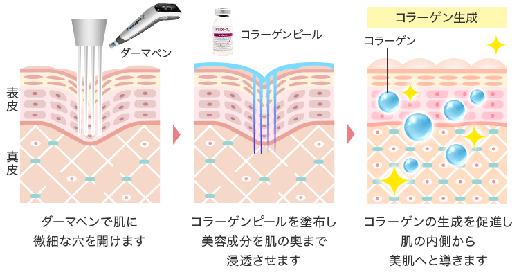 ベルベットスキンの仕組み