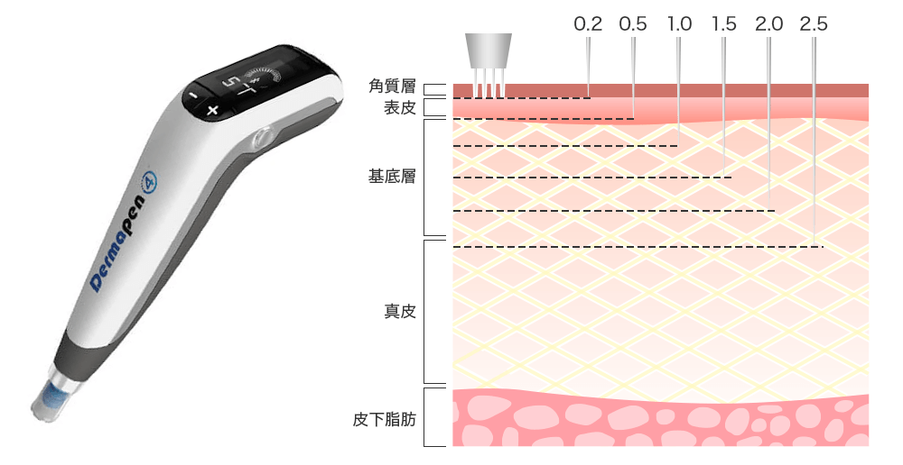ダーマペン4