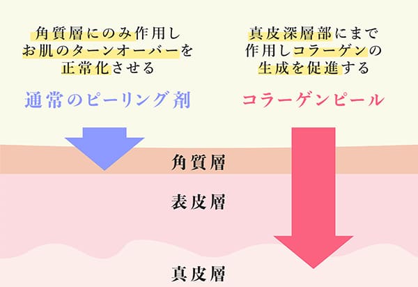 コラーゲンピールと通常のピーリング剤の効果の比較