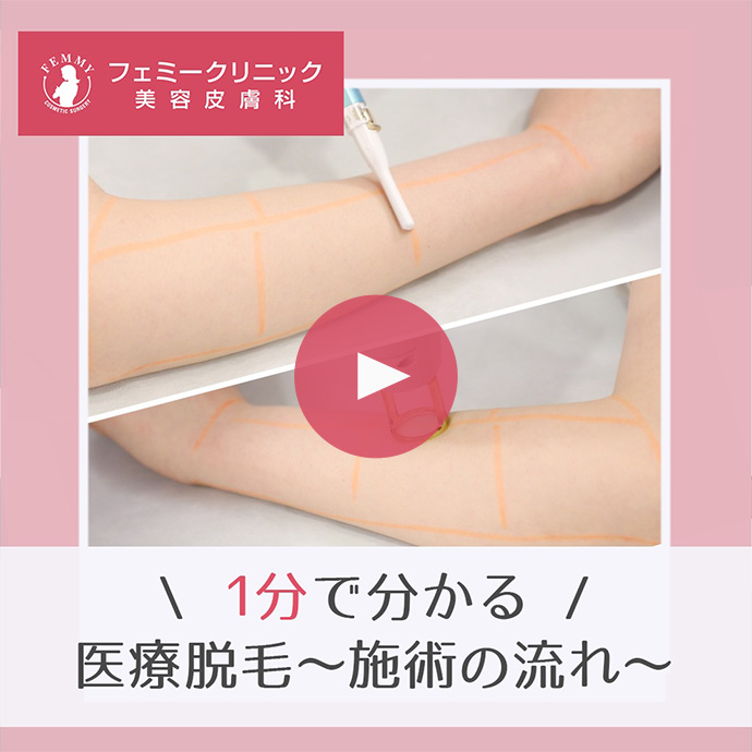 【1分で分かる】医療脱毛~施術の流れ~