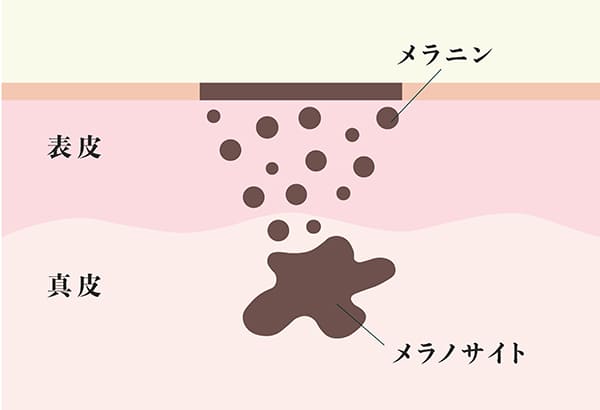 メラニンとメラノサイトの関係