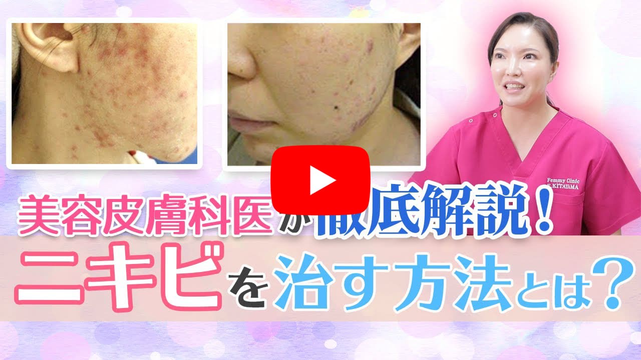 美容皮膚科医がニキビを治す方法を徹底解説